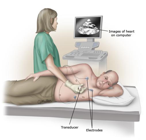 اکوکاردیوگرافی 